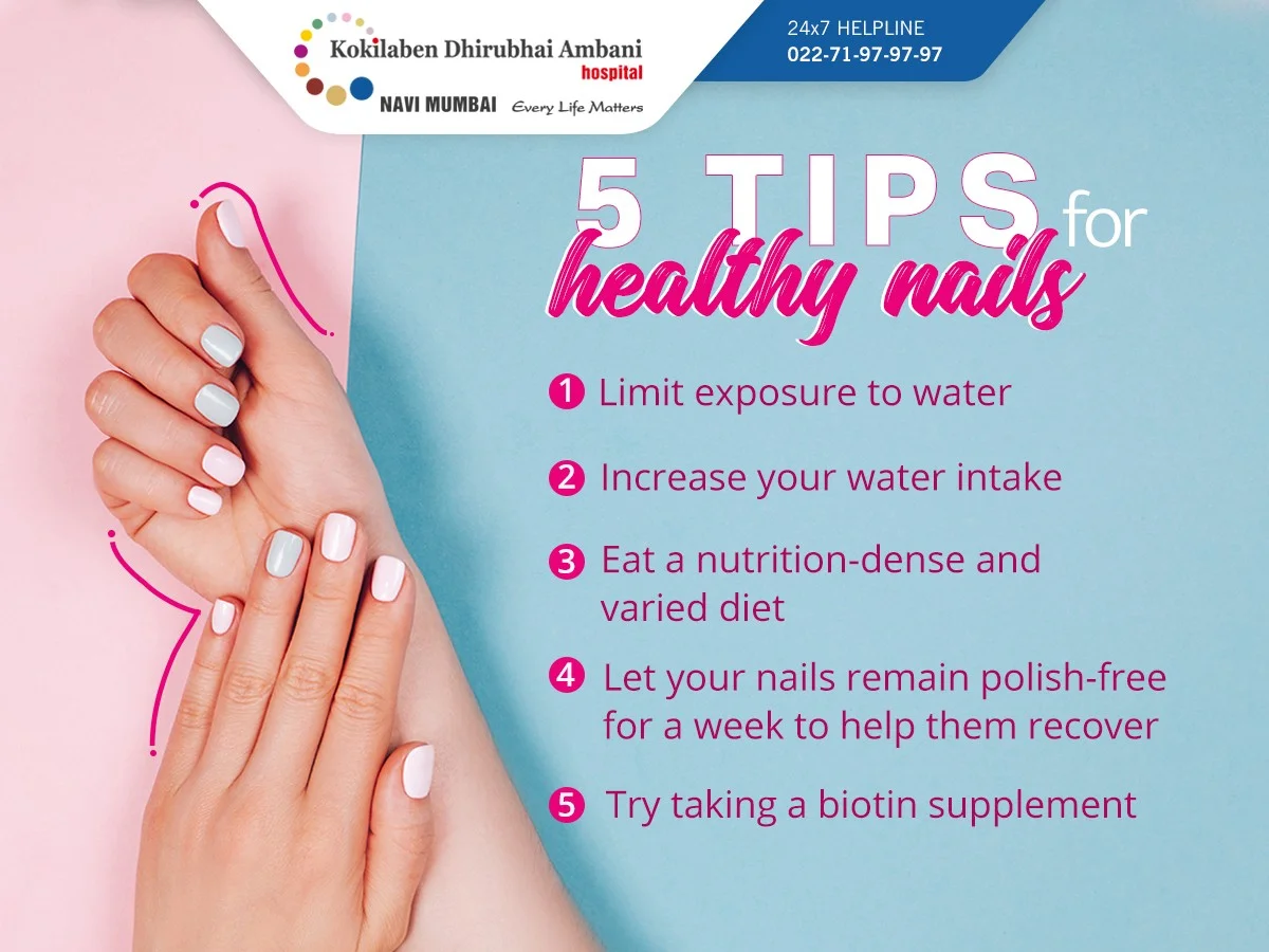 Co paznokcie mówią o Twoim zdrowiu. Niektóre zmiany mogą być sygnałem raka. - image 1