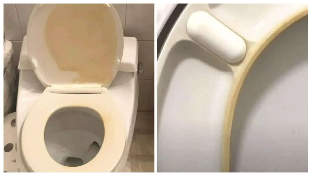 Zaskakujący sposób na usunięcie żółtych plam z deski sedesowej – Tani trik, który uratował mi połowę kosztów wymiany