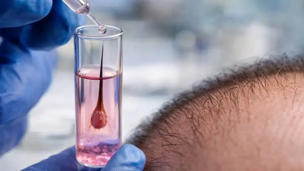 Z probówki na skórę głowy: stworzono w laboratorium w pełni funkcjonalne mieszki włosowe